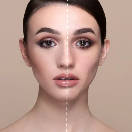 Mesauda Milano Pro Light Highly Moisturizing Fluid Concealer before and after