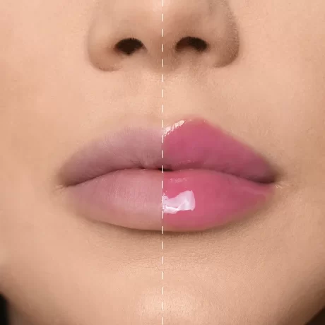 Mesauda Lip Phenom PH Lip Plumper before and after